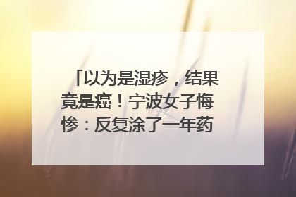 以为是湿疹，结果竟是癌！宁波女子悔惨：反复涂了一年药膏都没好！很多患者首诊都去了皮肤科